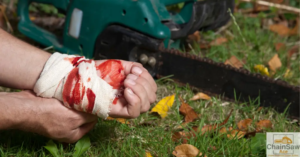 Chainsaw Catastrophes: Common Accidents and How to Avoid Them - Chainsaw Injury